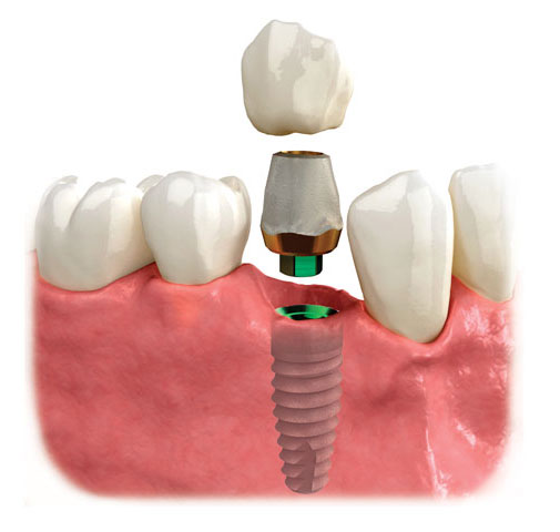 Dental X-Rays and Scans