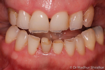 complex dentistry problem