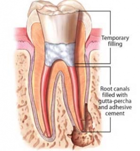 Teeth Roots