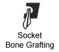 Socket Bone Grafting