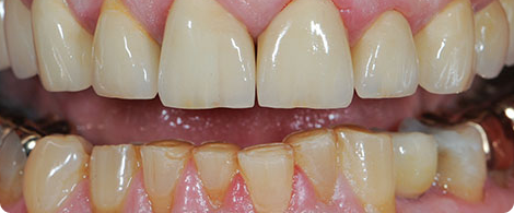 Cosmetic Dentistry – Bringing Out The Best In Smile! Cosmetic Dentistry – Bringing Out The Best In Smile!