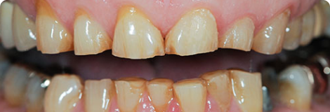 Cosmetic Dentistry – Bringing Out The Best In Smile! Cosmetic Dentistry – Bringing Out The Best In Smile!